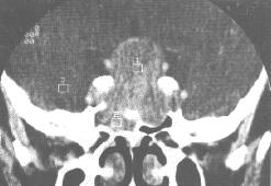 CT״棩