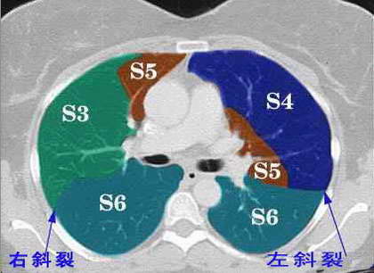 文章中心 癌症治疗 >> 正文                        右肺 左肺 上叶